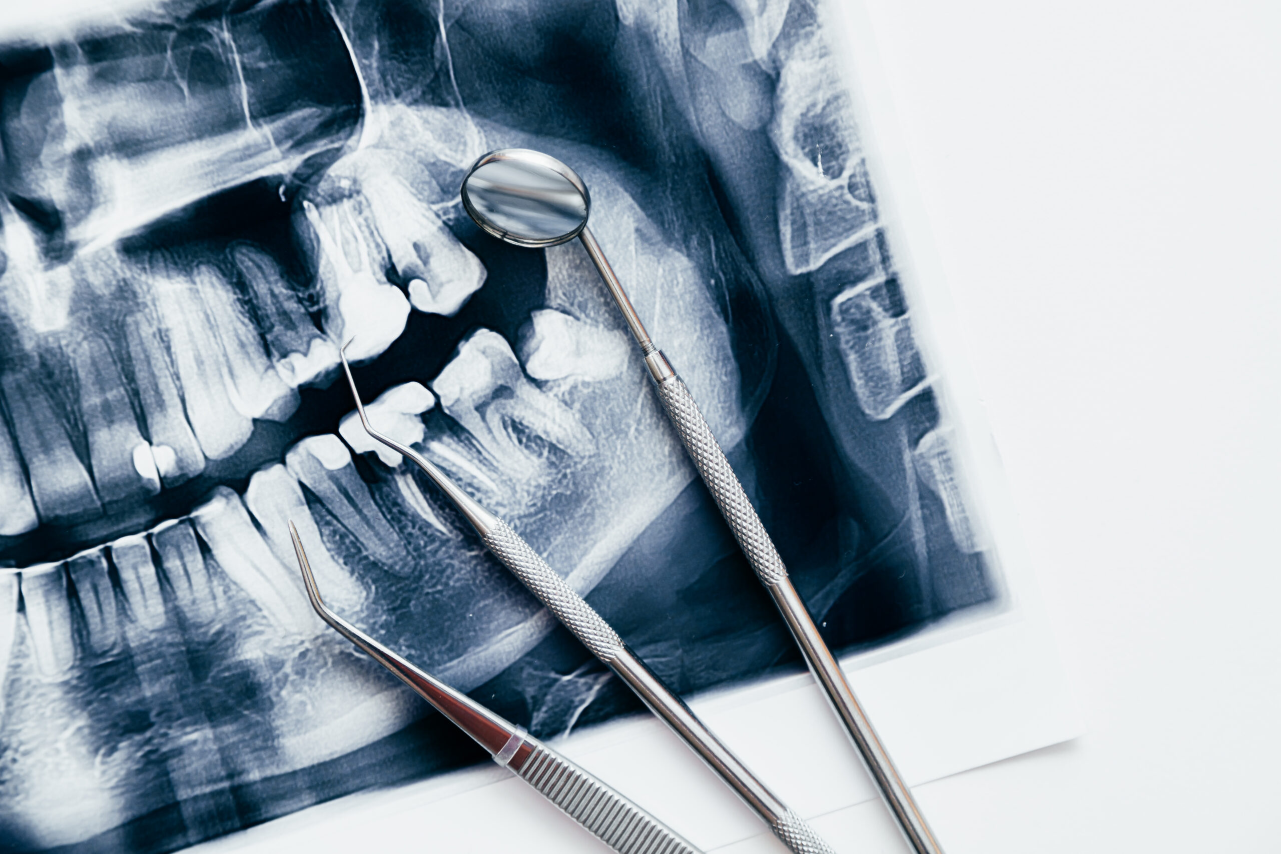 Dental toold and jaw x-ray. Dental treatment concept. Treatment of caries and pulpitis